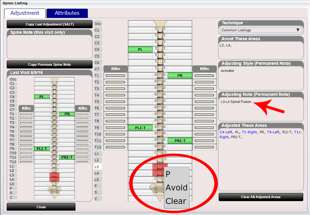 ChiroSpring Spinal Adjustments Mark Areas To Avoid