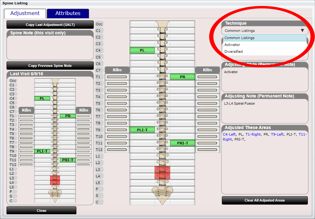ChiroSpring Spinal Adjustments Technique