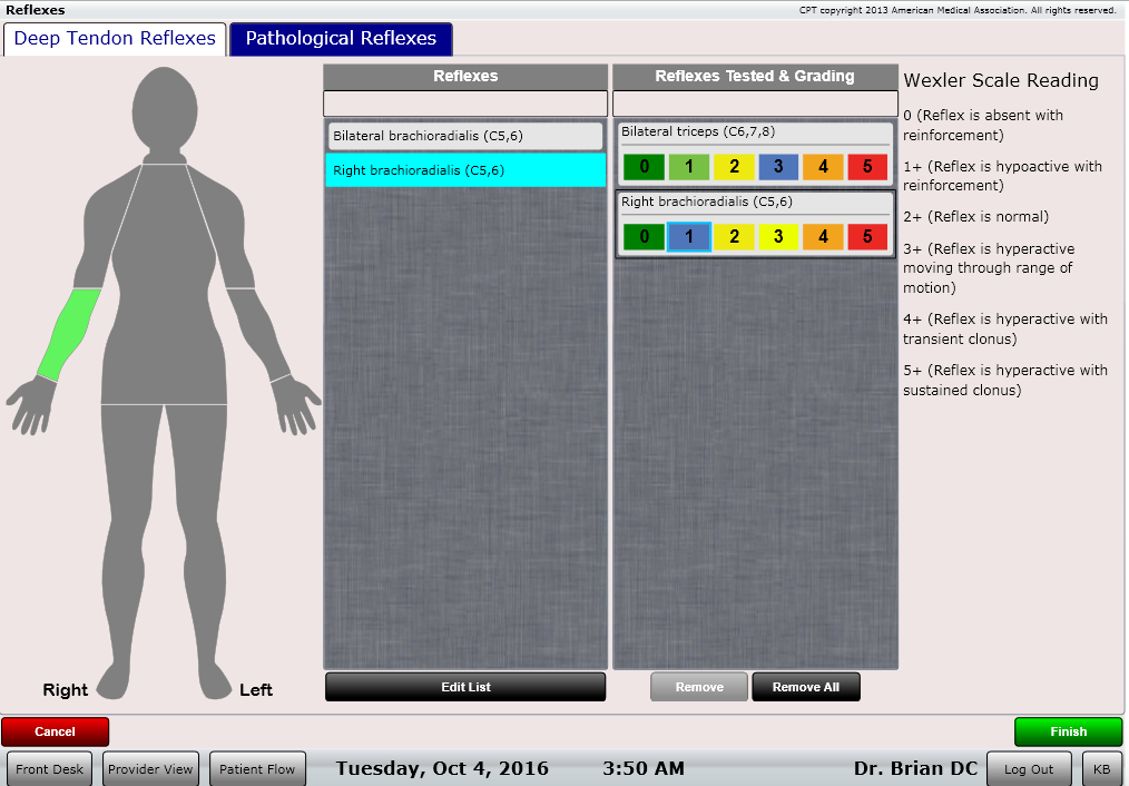 ChiroSpring Deep Tendon Reflexes