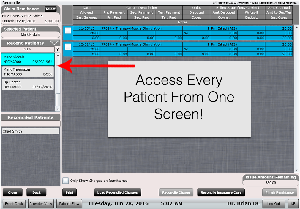 ChiroSpring Reconcile Process Fast